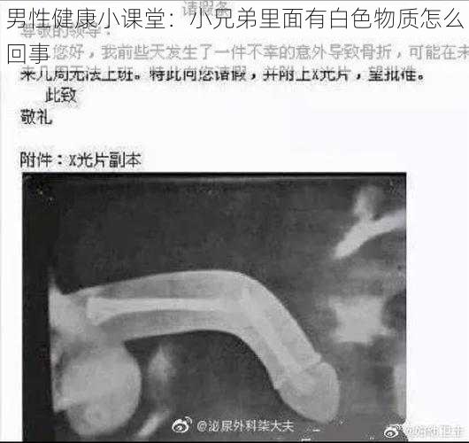 男性健康小课堂：小兄弟里面有白色物质怎么回事